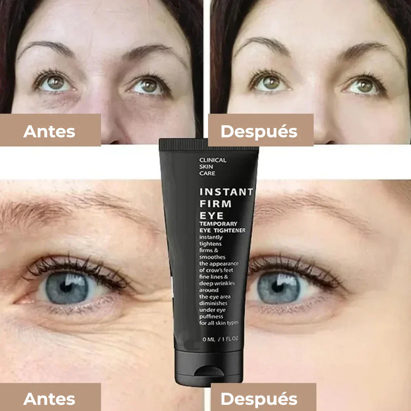 Crema Rejuvenecedora CELYN 🌟 (30 ml) ¡Rejuvenece Tu Mirada ! 🌸💖