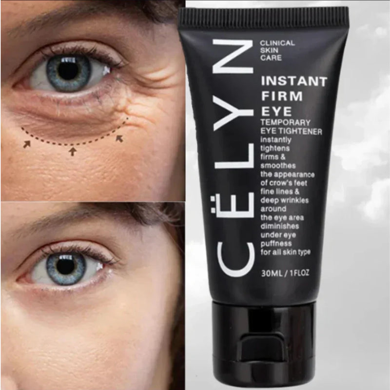 Crema Rejuvenecedora CELYN 🌟 (30 ml) ¡Rejuvenece Tu Mirada ! 🌸💖