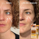 2X1 SOLO HOY Wokali con Q10™ 2x1 – Reduce bolsas y rejuvenece tu mirada