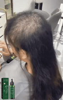 COMBO (2) SPRAY OUHOE